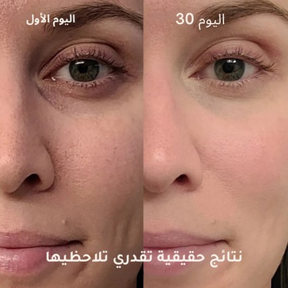 عصا لومورا للعناية بالبشرة 4 في 1 بتقنية الضوء الأحمر